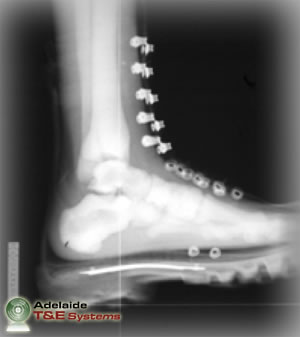 Frangible Surrogate Leg (FSL)